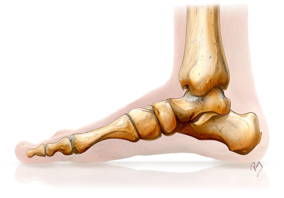 Flat Foot